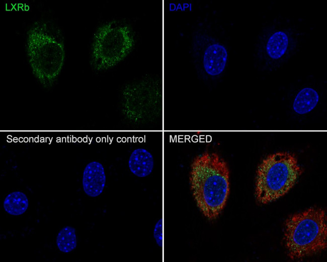 LXR beta Antibody in Immunocytochemistry (ICC/IF)