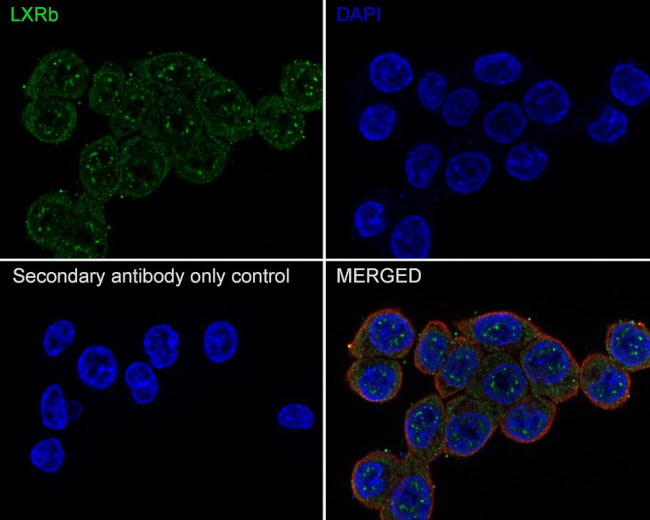 LXR beta Antibody in Immunocytochemistry (ICC/IF)