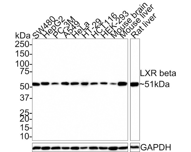 LXR beta Antibody in Western Blot (WB)