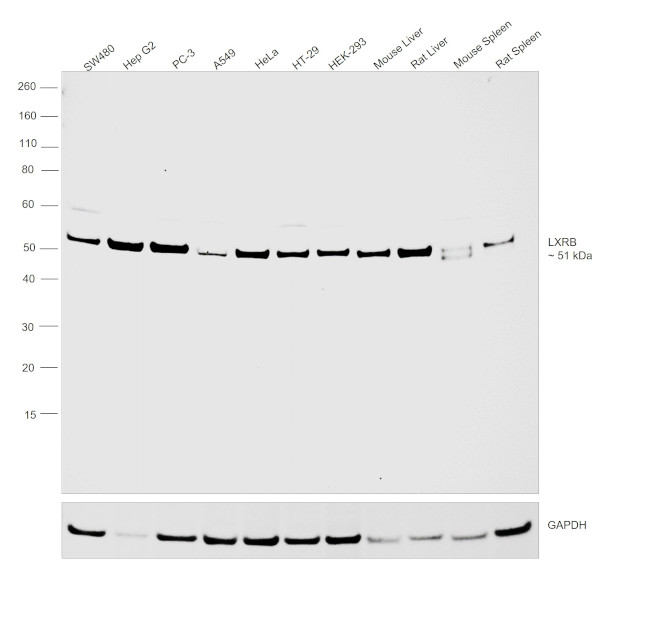 LXR beta Antibody in Western Blot (WB)