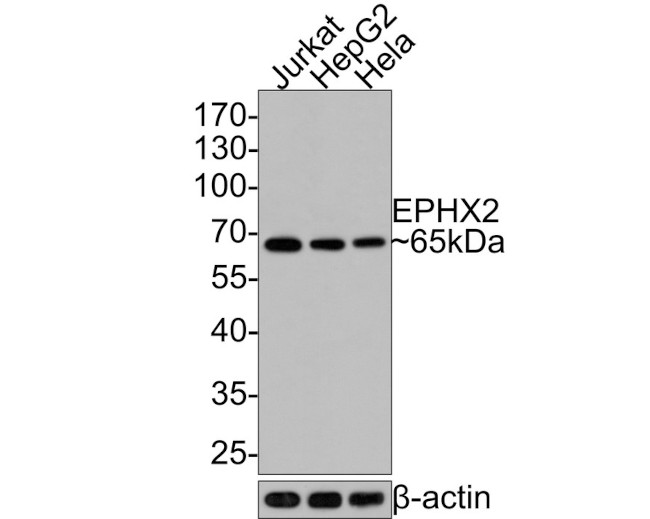 EPHX2 Antibody in Western Blot (WB)