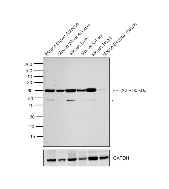 EPHX2 Antibody in Western Blot (WB)