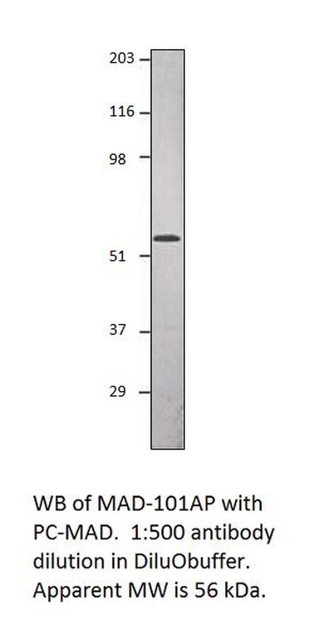 Smad1 Antibody in Western Blot (WB)