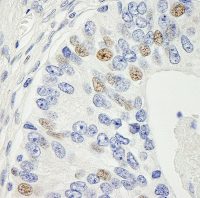 MAD1 Antibody in Immunohistochemistry (IHC)