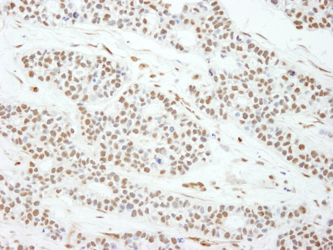 MAD2 Antibody in Immunohistochemistry (IHC)