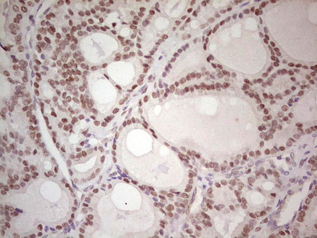 MAD2L1BP Antibody in Immunohistochemistry (Paraffin) (IHC (P))