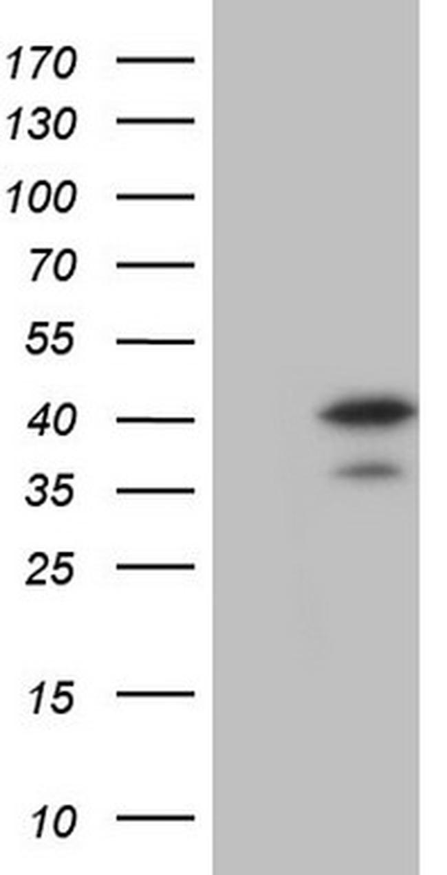 MAD2L1BP Antibody in Western Blot (WB)