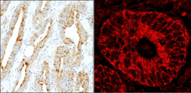 MADD Antibody in Immunohistochemistry (IHC)