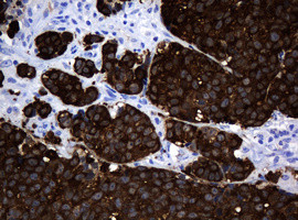 MAGEA3 Antibody in Immunohistochemistry (Paraffin) (IHC (P))