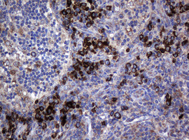 MAGEA3 Antibody in Immunohistochemistry (Paraffin) (IHC (P))