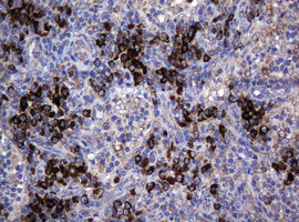 MAGEA3 Antibody in Immunohistochemistry (Paraffin) (IHC (P))