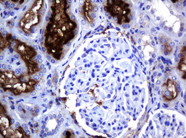 MAGEA3 Antibody in Immunohistochemistry (Paraffin) (IHC (P))