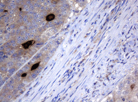 MAGEA3 Antibody in Immunohistochemistry (Paraffin) (IHC (P))