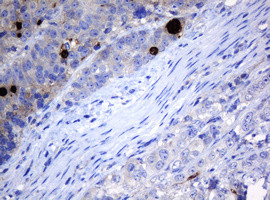 MAGEA3 Antibody in Immunohistochemistry (Paraffin) (IHC (P))