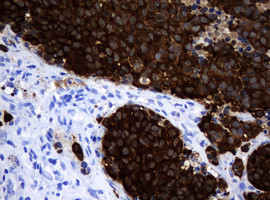 MAGEA3 Antibody in Immunohistochemistry (Paraffin) (IHC (P))