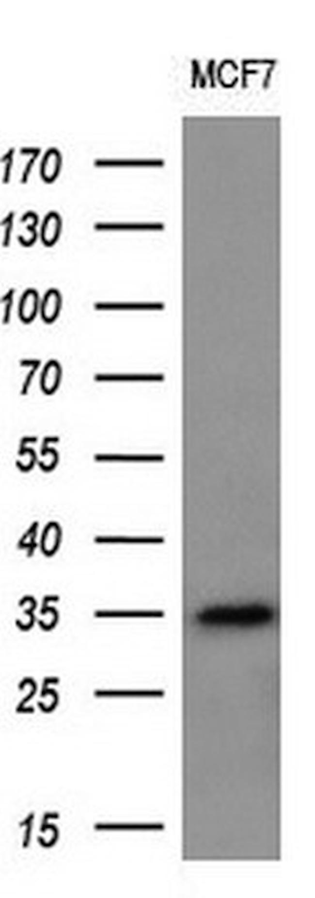 MAGEA3 Antibody in Western Blot (WB)