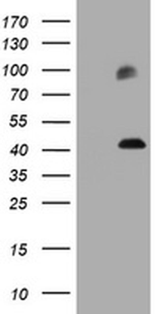 MAGEA3 Antibody in Western Blot (WB)