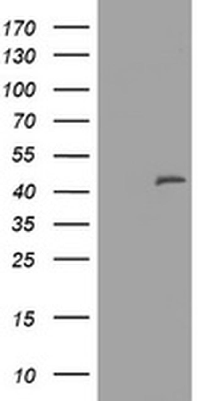 MAGEA3 Antibody in Western Blot (WB)