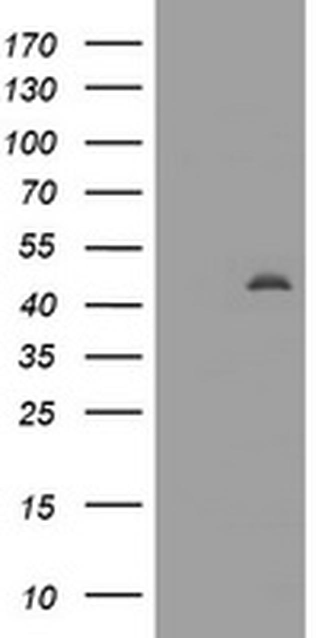 MAGEA3 Antibody in Western Blot (WB)