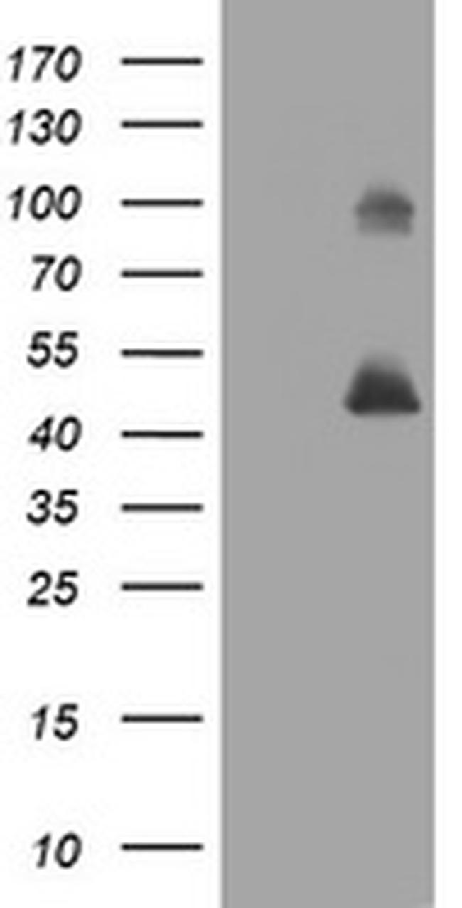 MAGEA3 Antibody in Western Blot (WB)