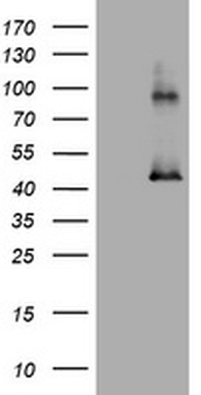 MAGEA3 Antibody in Western Blot (WB)