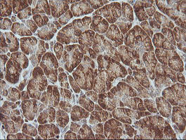 MAGEA4 Antibody in Immunohistochemistry (Paraffin) (IHC (P))