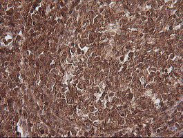 MAGEA4 Antibody in Immunohistochemistry (Paraffin) (IHC (P))