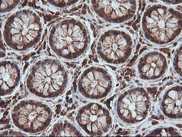 MAGEA4 Antibody in Immunohistochemistry (Paraffin) (IHC (P))