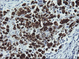 MAGEA4 Antibody in Immunohistochemistry (Paraffin) (IHC (P))