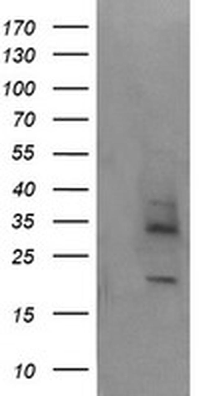 MAGEA4 Antibody in Western Blot (WB)