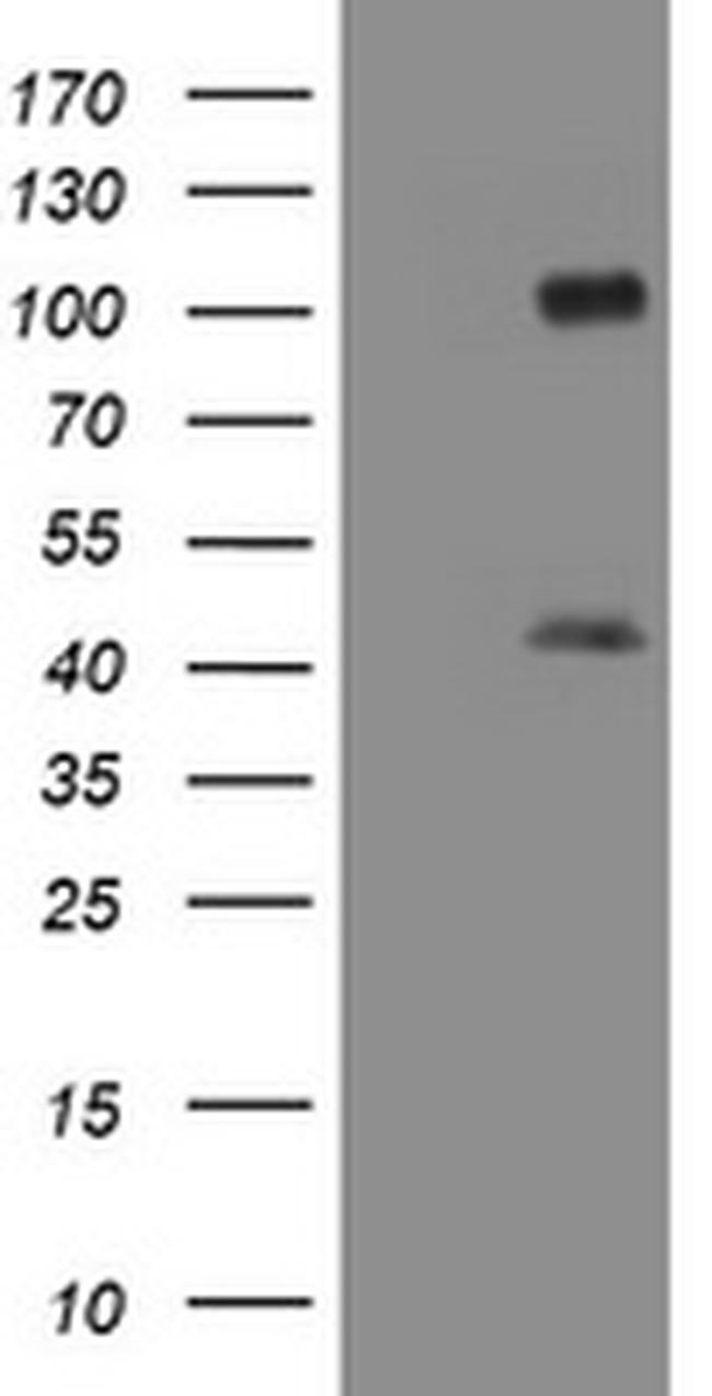 MAGEA9 Antibody in Western Blot (WB)