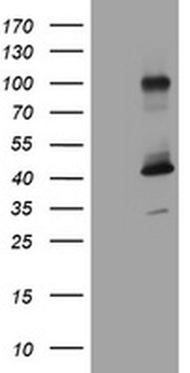 MAGEA9 Antibody in Western Blot (WB)