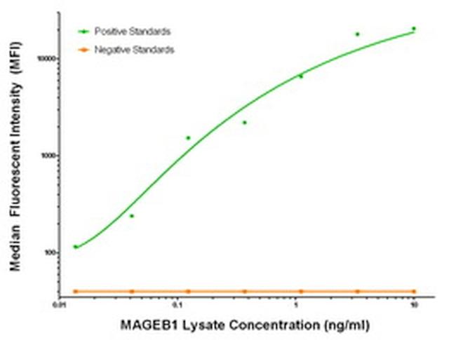 MAGEB1 Antibody in Luminex (LUM)