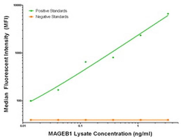 MAGEB1 Antibody in Luminex (LUM)