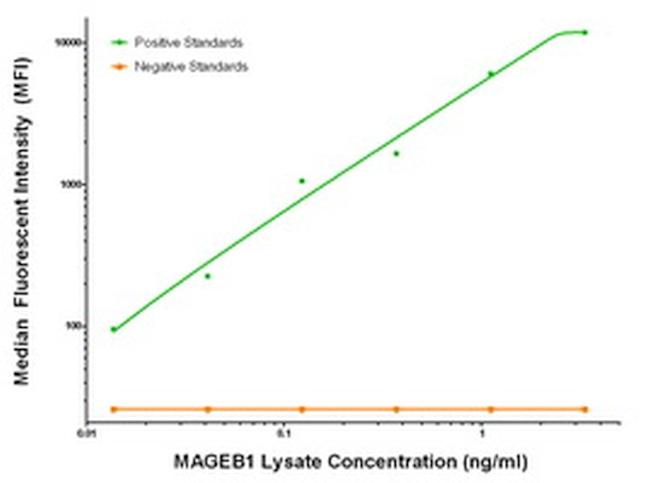 MAGEB1 Antibody in Luminex (LUM)