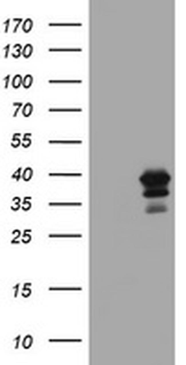 MAGEB18 Antibody in Western Blot (WB)