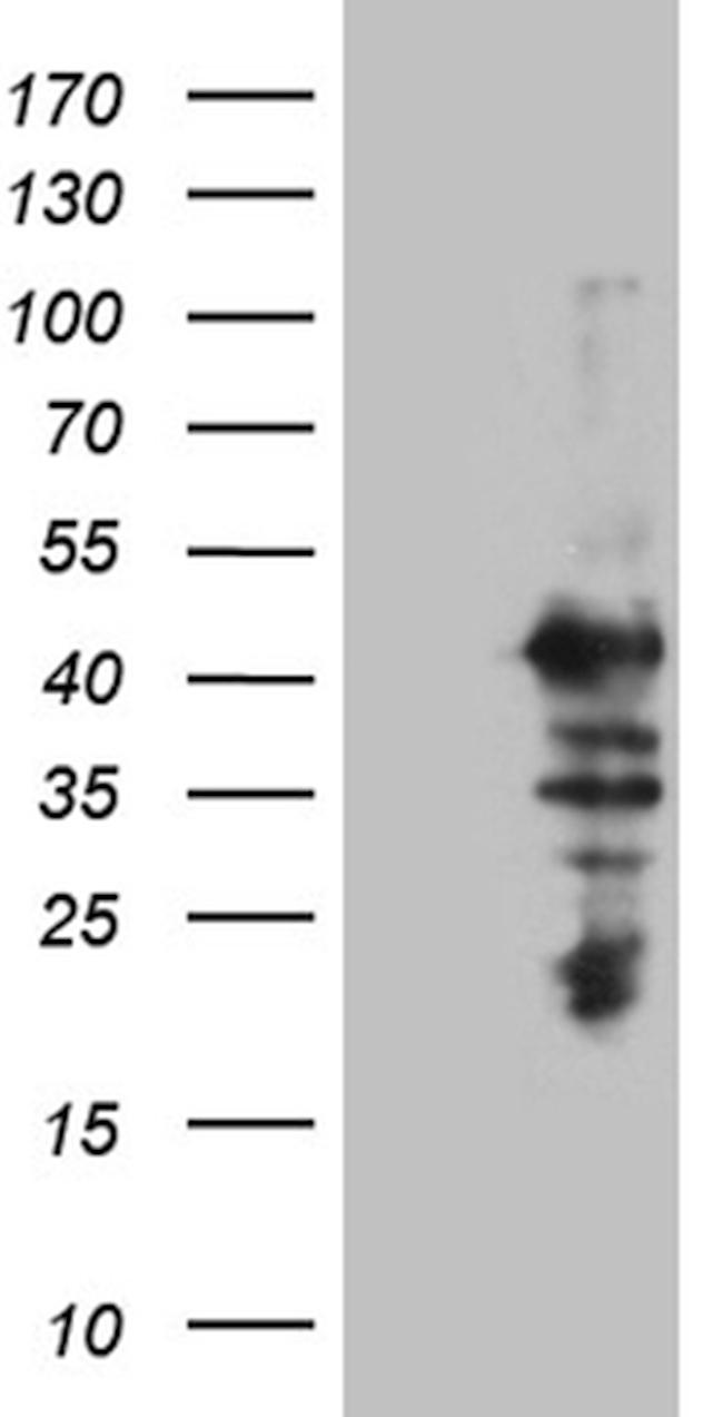 MAGEB2 Antibody in Western Blot (WB)