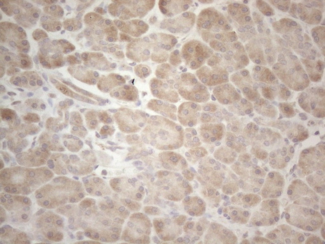 MAGEB3 Antibody in Immunohistochemistry (Paraffin) (IHC (P))