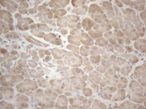 MAGEB3 Antibody in Immunohistochemistry (Paraffin) (IHC (P))