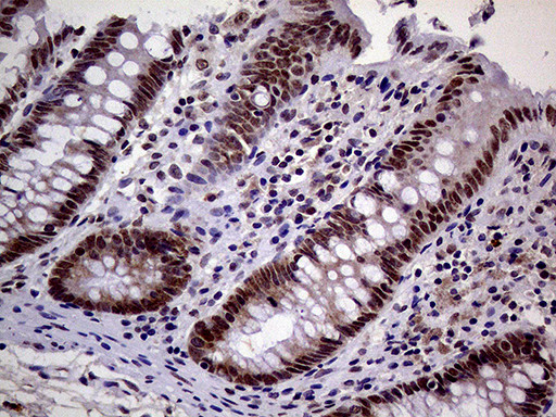 MAGEB4 Antibody in Immunohistochemistry (Paraffin) (IHC (P))