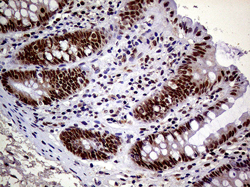 MAGEB4 Antibody in Immunohistochemistry (Paraffin) (IHC (P))