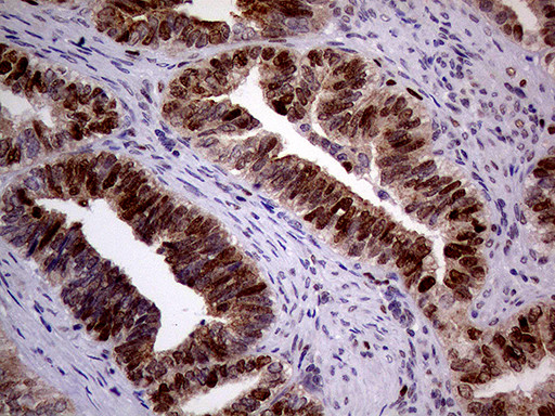 MAGEB4 Antibody in Immunohistochemistry (Paraffin) (IHC (P))