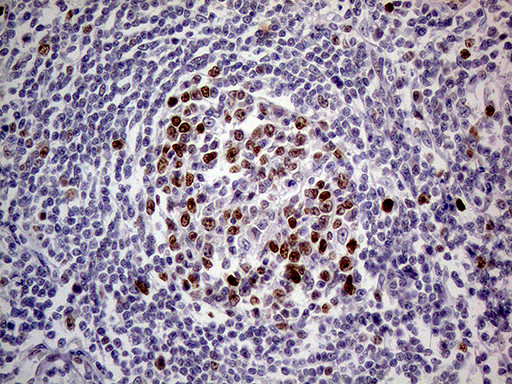 MAGEB4 Antibody in Immunohistochemistry (Paraffin) (IHC (P))