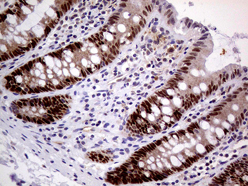 MAGEB4 Antibody in Immunohistochemistry (Paraffin) (IHC (P))