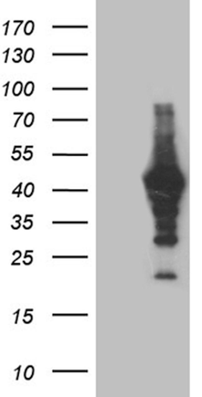 MAGEB4 Antibody in Western Blot (WB)