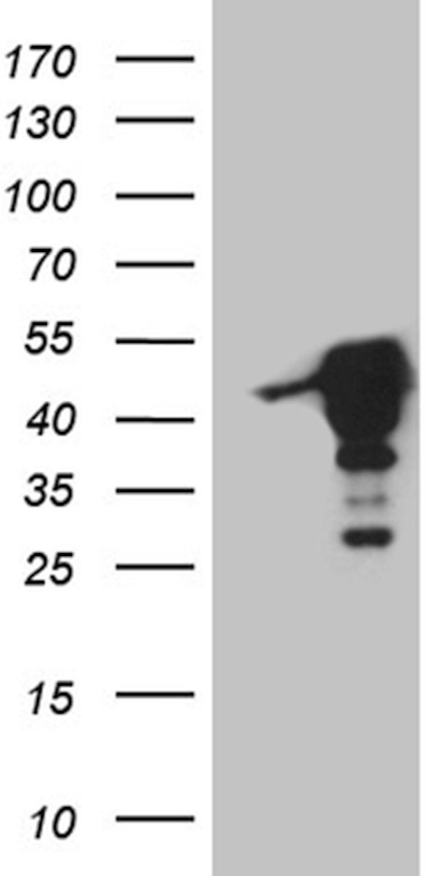 MAGEB4 Antibody in Western Blot (WB)