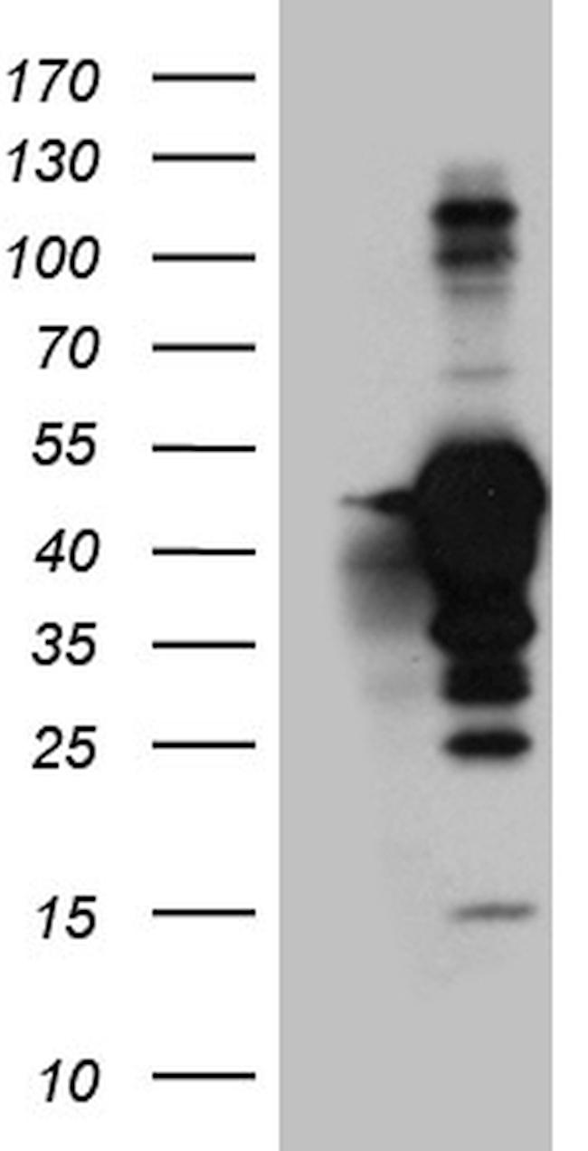 MAGEB4 Antibody in Western Blot (WB)