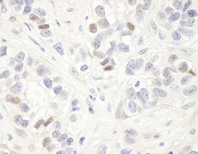 MAGED2 Antibody in Immunohistochemistry (IHC)