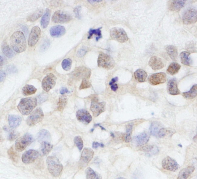 MAGED2 Antibody in Immunohistochemistry (IHC)