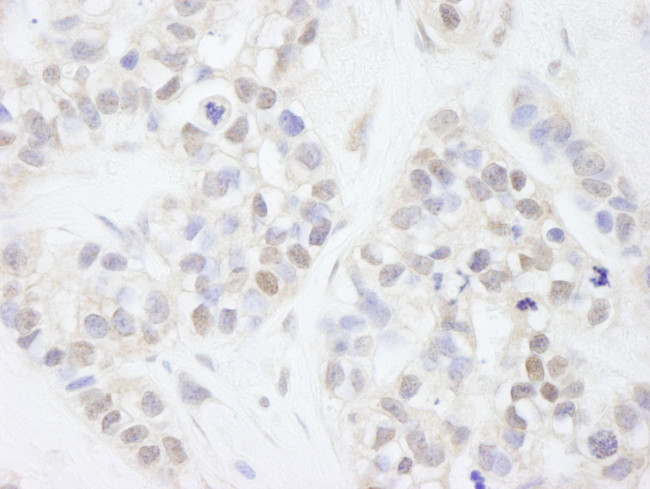 MAGED2 Antibody in Immunohistochemistry (IHC)